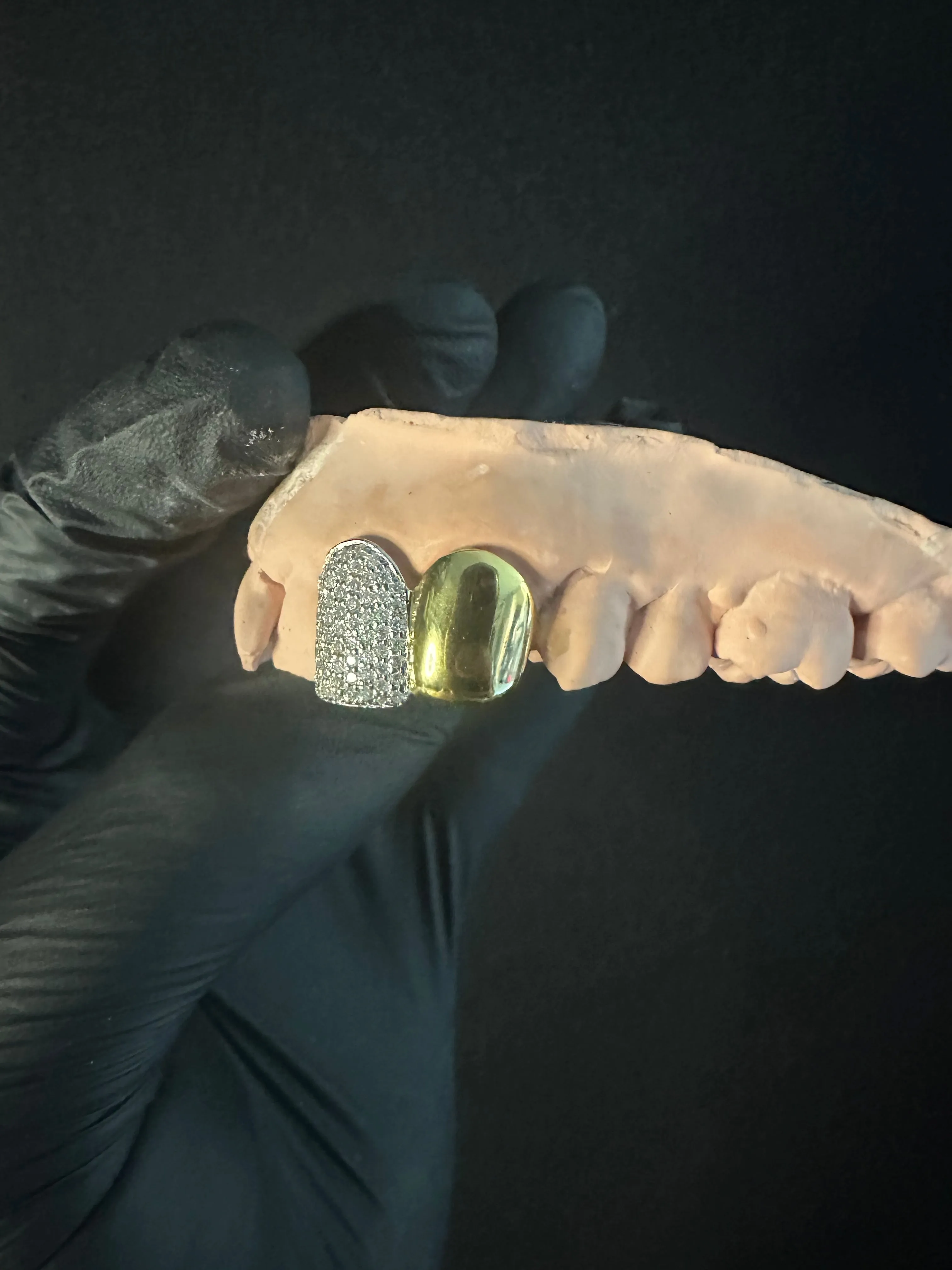 Custom VVS Grillz 2 Caps ice/gld