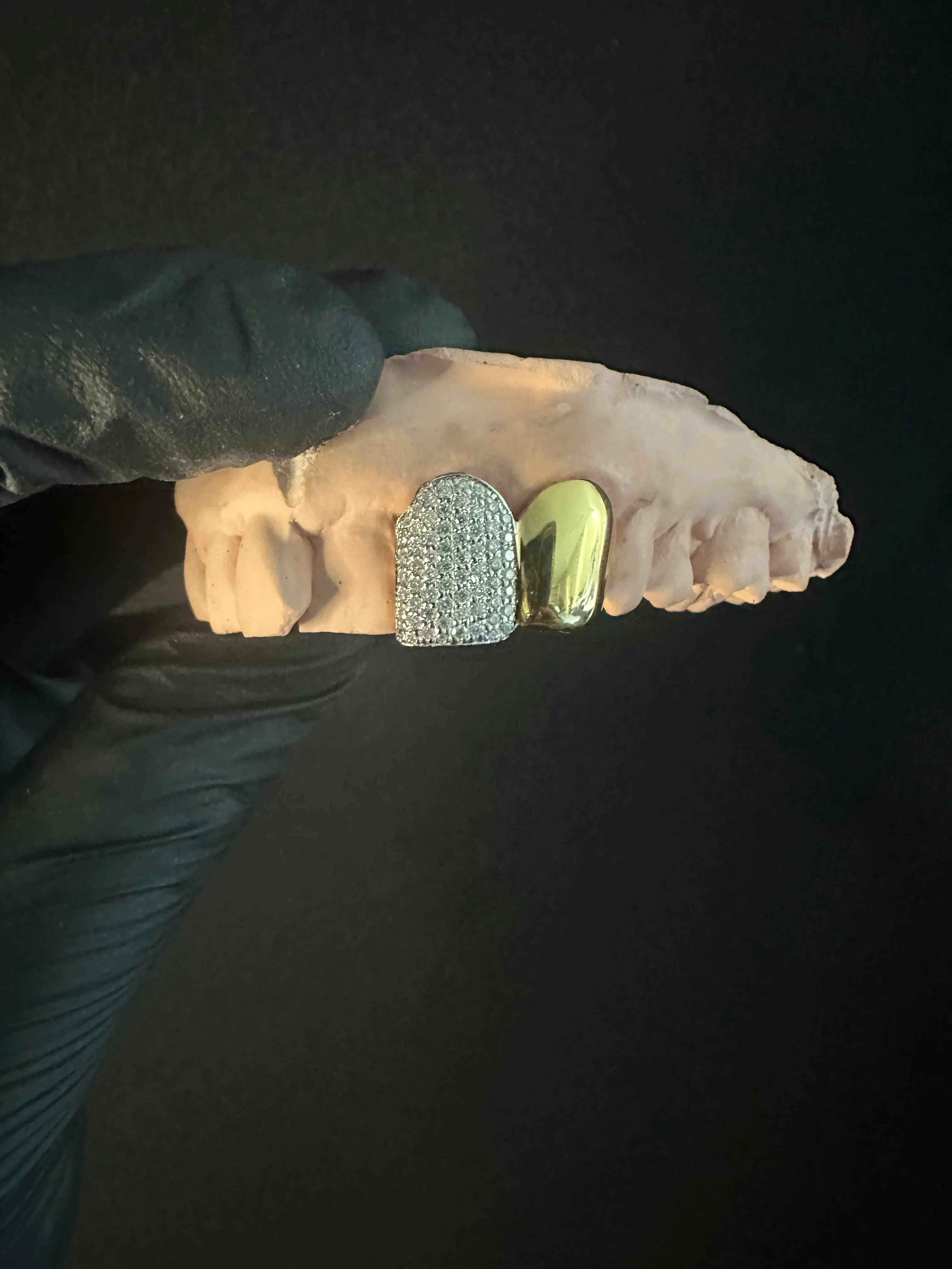 Custom VVS Grillz 2 Caps ice/gld